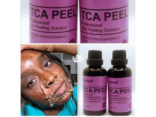 TCA Acid Chemical Professional Peel.10% to 100% Available