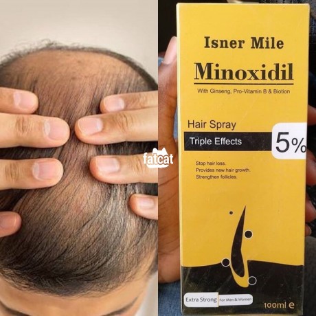 Classified Ads In Nigeria, Best Post Free Ads - isner-mile-minoxidil-5-extra-strong-to-regrow-new-hair-and-stop-hair-loss-big-0