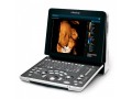 mindray-z60-4d-color-doppler-ultrasound-machine-small-1