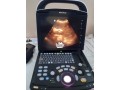 ultrasound-machine-small-2
