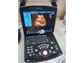 ultrasound-machine-small-0
