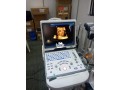 ultrasound-machine-small-0