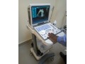 ultrasound-machine-small-1